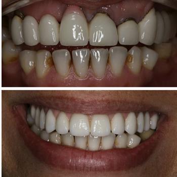 About Smiles Dental Centres - Case #2