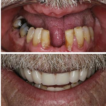 About Smiles Dental Centres - Case #4