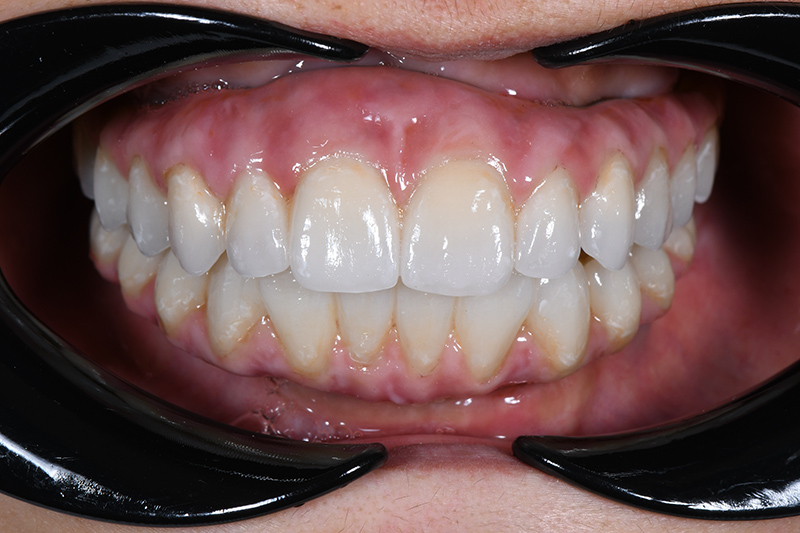 About Smiles Dental Centres Patient